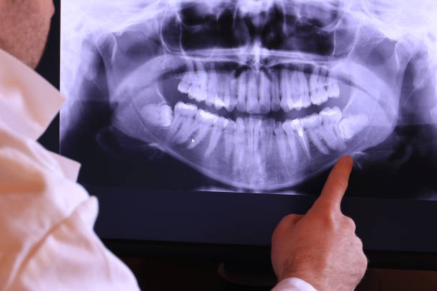 Best Emergency Treatment for Oral Infections in , NM